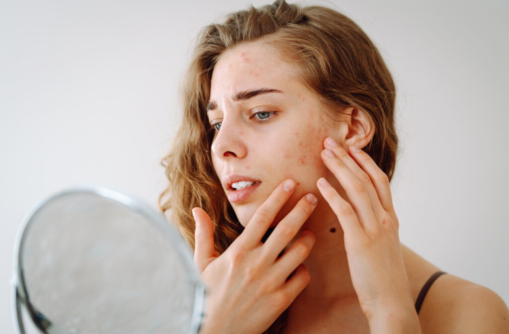 A beautiful woman looking in the mirror, touching her face with her hand, examines acne, pigmentation. Cosmetic care. Allergic reaction. Health concept, cosmetology.