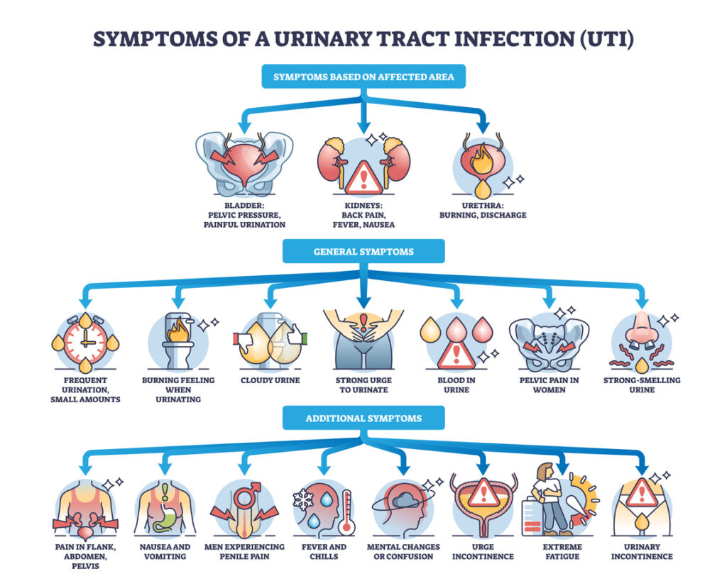 Recurring UTIs: Visual breakdown of UTI Symptoms